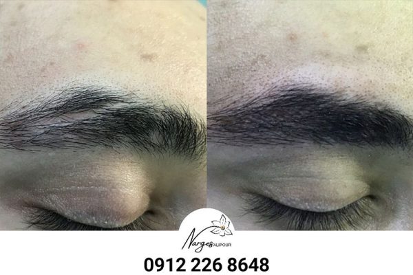 میکروپیگمنتیشن ابرو